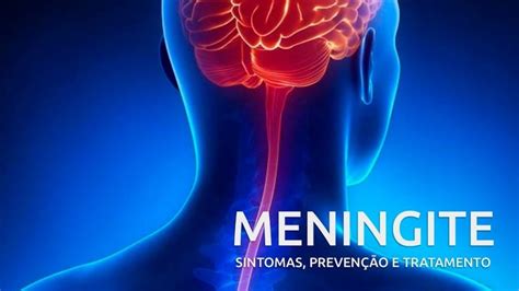 meningite meningocócica cid